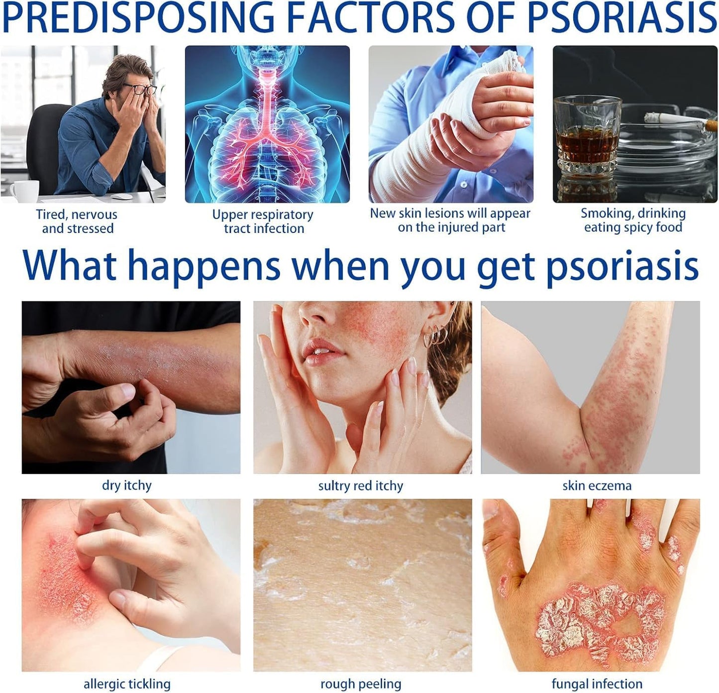 🌿 Herbal Psoriasis Repair Balm 🌸 Deep Relief for Stubborn, Flaky Skin