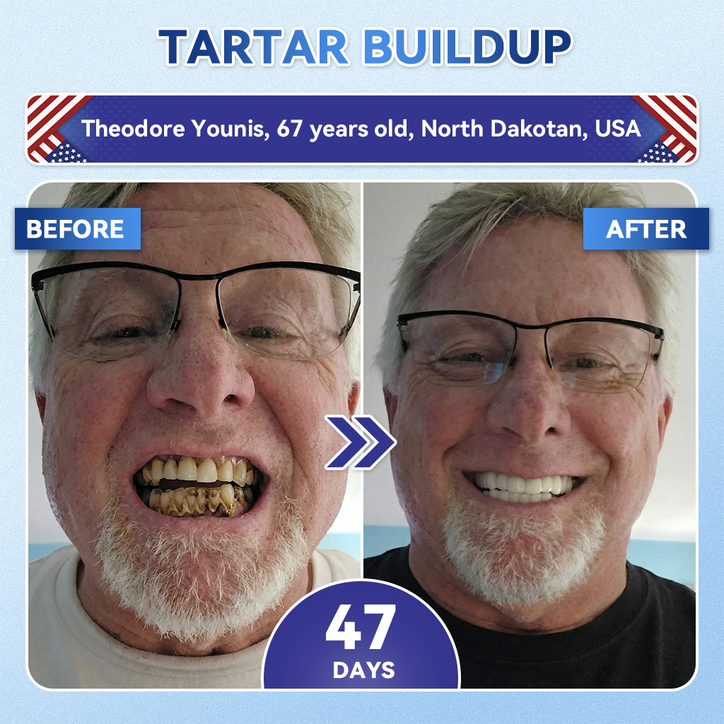 LUMIVO® 🦷 Tideglusib Oral Strips 💡 Fast-Dissolving Tooth & Gum Care for Stronger, Healthier Smiles 😁