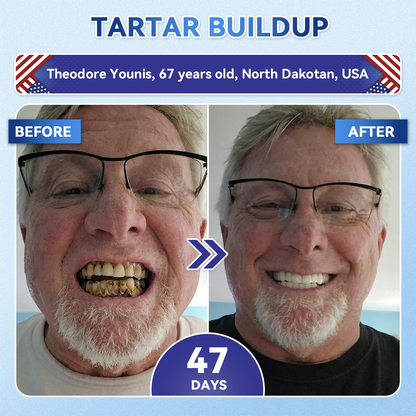 LUMIVO® 🦷 Tideglusib Oral Strips 💡 Fast-Dissolving Tooth & Gum Care for Stronger, Healthier Smiles 😁