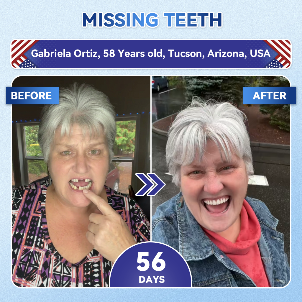 LUMIVO® 🦷 Tideglusib Oral Strips 💡 Fast-Dissolving Tooth & Gum Care for Stronger, Healthier Smiles 😁