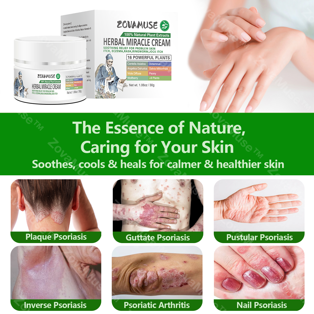 Herbal Miracle Cream for Stubborn Skin Issues