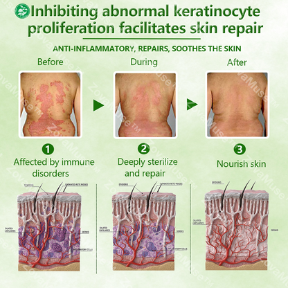 Herbal Miracle Cream for Stubborn Skin Issues