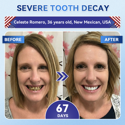 LUMIVO® 🦷 Tideglusib Oral Strips 💡 Fast-Dissolving Tooth & Gum Care for Stronger, Healthier Smiles 😁