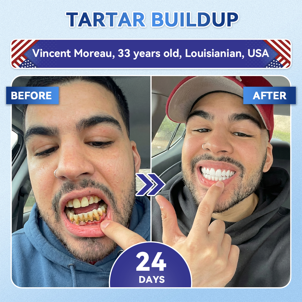 LUMIVO® 🦷 Tideglusib Oral Strips 💡 Fast-Dissolving Tooth & Gum Care for Stronger, Healthier Smiles 😁