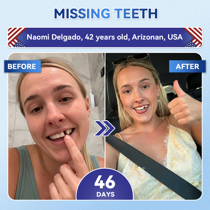 LUMIVO® 🦷 Tideglusib Oral Strips 💡 Fast-Dissolving Tooth & Gum Care for Stronger, Healthier Smiles 😁