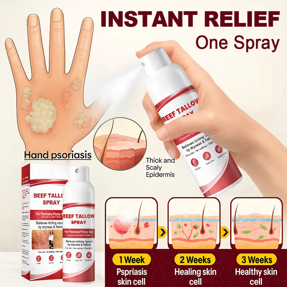 Beef Tallow Spray for Itchy, Flaky Psoriasis Skin