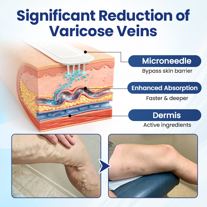 LUMIVO® Deep Vein Repair Microneedle Patch