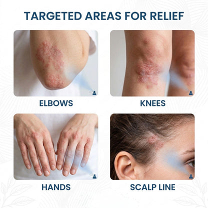 🔥LUMIVO® Magnesium Botanical Spray – Advanced Skin Recovery for Psoriasis & Eczema | Rapid Soothing, Steroid-Free