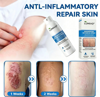 🔥LUMIVO® Magnesium Botanical Spray – Advanced Skin Recovery for Psoriasis & Eczema | Rapid Soothing, Steroid-Free