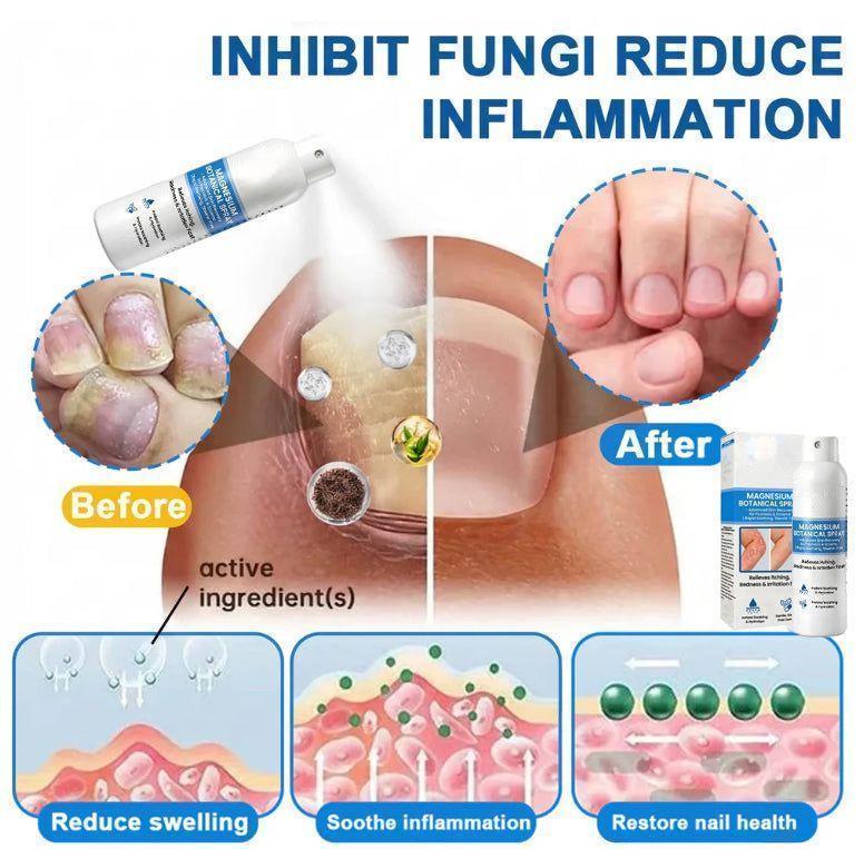 🔥LUMIVO® Magnesium Botanical Spray – Advanced Skin Recovery for Psoriasis & Eczema | Rapid Soothing, Steroid-Free