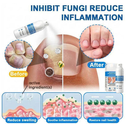 🔥LUMIVO® Magnesium Botanical Spray – Advanced Skin Recovery for Psoriasis & Eczema | Rapid Soothing, Steroid-Free